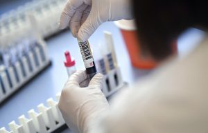 На Черкащині 331 випадок інфікування коронавірусом