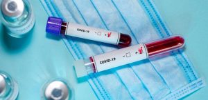348: оперативна інформація щодо випадків коронавірусу в області