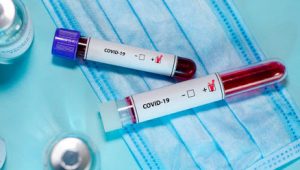 401: на Черкащині за останню добу виявили ще 8 випадків інфікування коронавірусом