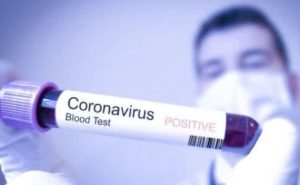 564: остання інформація щодо інфікування коронавірусом в області