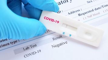 COVID-19: за останню добу виявили 72 нових випадки інфікування