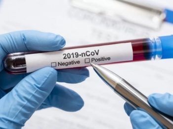 Десять нових випадків коронавірусної інфекції виявили за добу на Черкащині